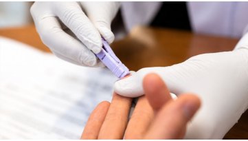 Test HIV: quando farlo e come funziona l’autotest in farmacia