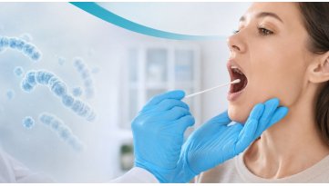 Tampone streptococco in farmacia: quando farlo e come leggere il risultato