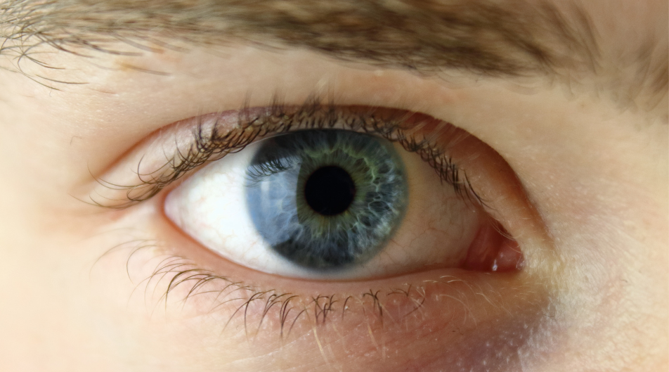 Secchezza oculare: cause e trattamento